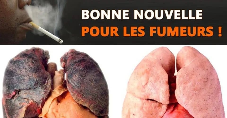 You are currently viewing Cure Détox Anti-Tabac : 70 % des Toxines du Tabac Éliminées